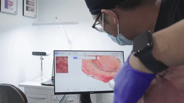 What Makes a 3D Printer Suitable for Dental Models?
